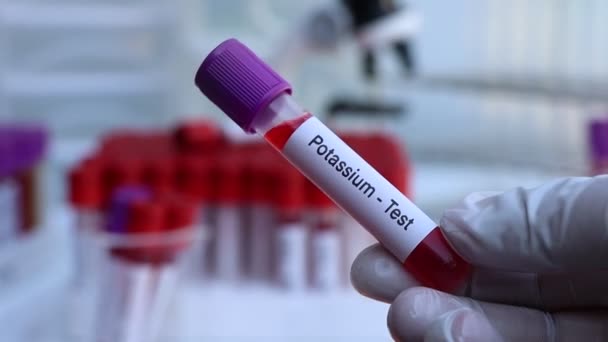 Test Del Potassio Cercare Anomalie Dal Sangue Campione Sangue Analizzare — Video Stock
