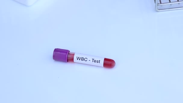 Wbc Δοκιμή Για Ψάξουν Για Ανωμαλίες Από Αίμα Δείγμα Αίματος — Αρχείο Βίντεο