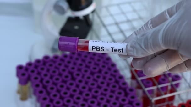Test Pbs Ricerca Anomalie Sangue Campione Sangue Analizzare Laboratorio Sangue — Video Stock