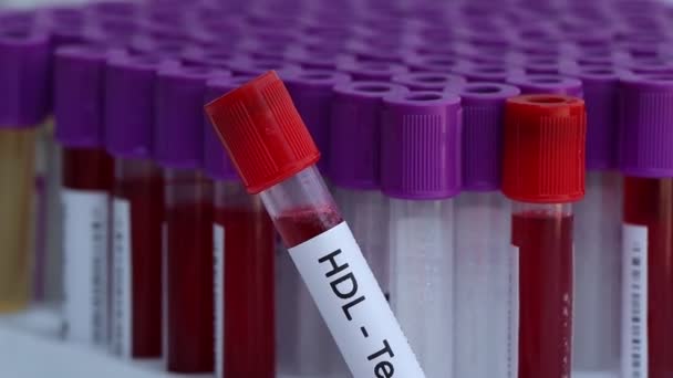 Hdl Δοκιμή Για Ψάξουν Για Ανωμαλίες Από Αίμα Δείγμα Αίματος — Αρχείο Βίντεο