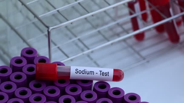 Tes Natrium Untuk Mencari Kelainan Dari Darah Sampel Darah Untuk — Stok Video