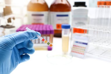 Urine and universal indicator paper, Litmus Paper of ph Value Measurement, laboratory inspection equipment