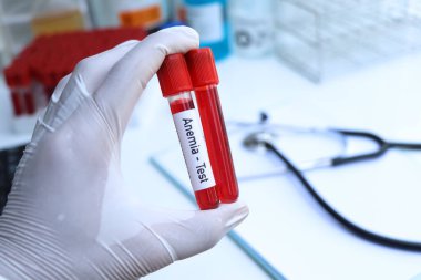 anemia test to look for abnormalities from blood,  blood sample to analyze in the laboratory, blood in test tube
