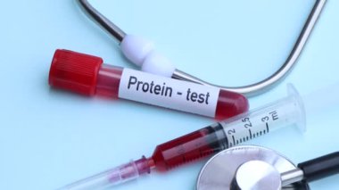 protein test to look for abnormalities from blood,  blood sample to analyze in the laboratory, blood in test tube