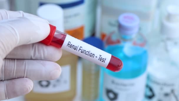 Renal Function Test Look Abnormalities Blood Blood Sample Analyze Laboratory — Stok Video