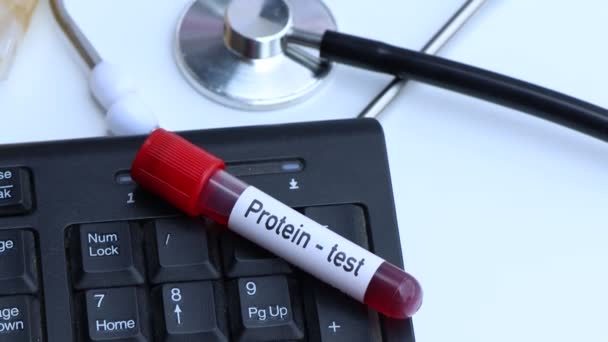 Protein Test Look Abnormalities Blood Blood Sample Analyze Laboratory Blood — Vídeo de stock