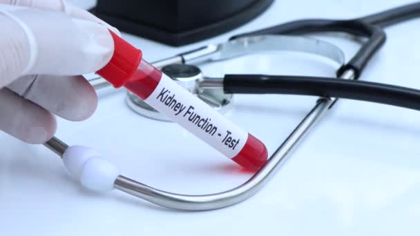 Kidney Function Test Look Abnormalities Blood Blood Sample Analyze Laboratory — Video