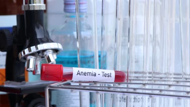 Test Anémie Pour Rechercher Des Anomalies Sang Échantillon Sang Analyser — Video