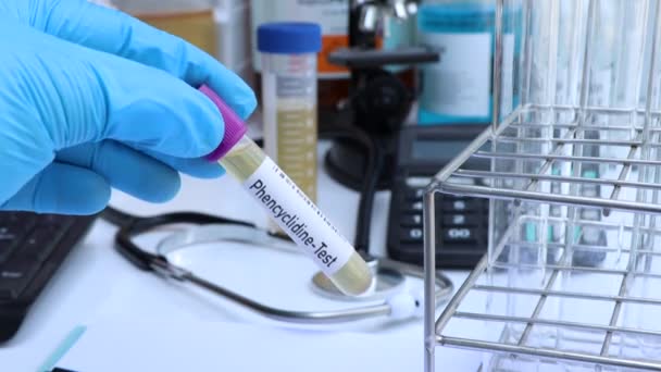 Phencyclidine Test Look Abnormalities Urine Urine Sample Analyze Laboratory Urine — Stockvideo
