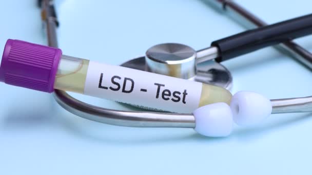 Teste Lsd Para Procurar Anormalidades Urina Amostra Urina Para Analisar — Vídeo de Stock