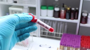 Kandaki anormallikleri araştırmak için kan pH testi laboratuvarda analiz edilecek kan örneği, test tüpünde kan.