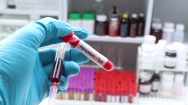 Alprazolam testinde kandaki anormallikler, laboratuarda analiz edilecek kan örnekleri, test tüpündeki kan örnekleri aranıyor.