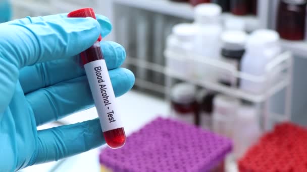 血液酒精检测从血液中寻找异常 血液样本在实验室分析 血液在试管中检测 — 图库视频影像