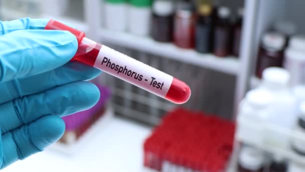 磷检测检查血液中的异常情况 血样在实验室分析 血样在试管中 — 图库视频影像