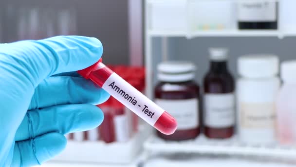 Teste Amônia Para Procurar Anormalidades Sangue Amostra Sangue Para Analisar — Vídeo de Stock