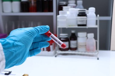 Kandaki anormallikleri bulmak için amonyak testi laboratuvarda analiz edilecek kan örneği, test tüpünde kan.