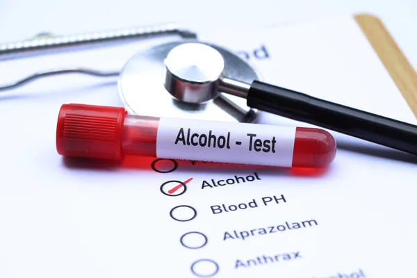 Teste Álcool Para Procurar Anormalidades Sangue Amostra Sangue Para Analisar — Fotografia de Stock