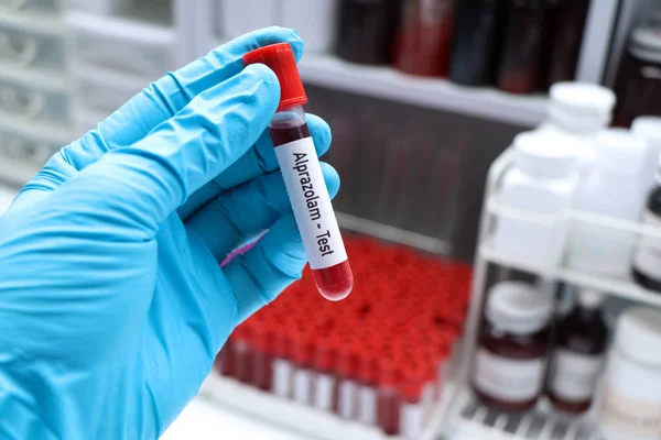 stock image Alprazolam test to look for abnormalities from blood,  blood sample to analyze in the laboratory, blood in test tube