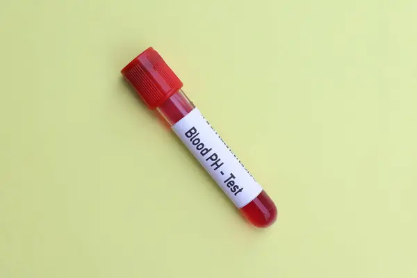 Тест Крові Пошуку Аномалій Від Крові Аналіз Крові Лабораторії Кров — стокове фото