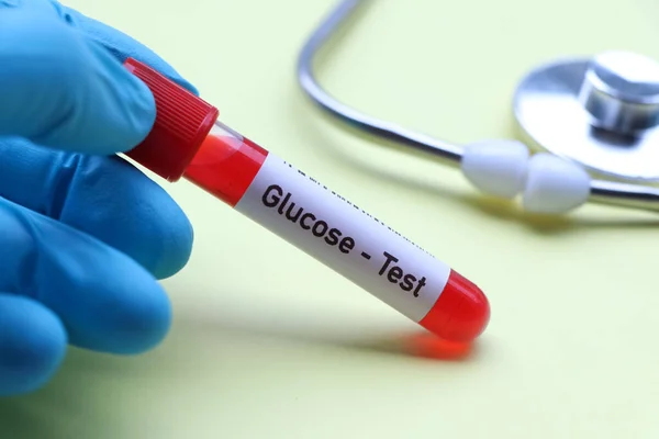 Prueba Glucosa Para Buscar Anomalías Sangre Muestra Sangre Para Analizar — Foto de Stock