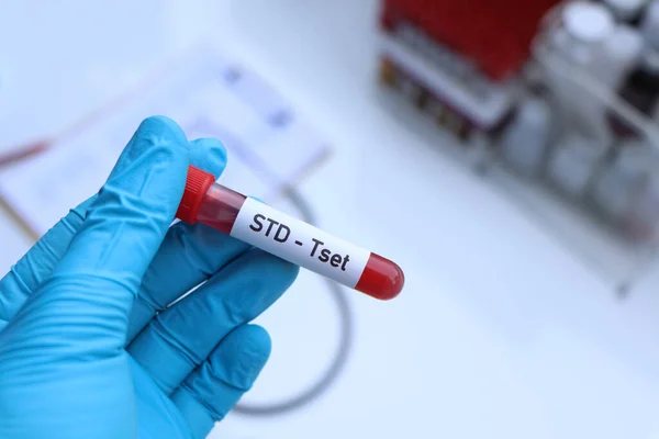 Test Std Cercare Anomalie Dal Sangue Campione Sangue Analizzare Laboratorio — Foto Stock