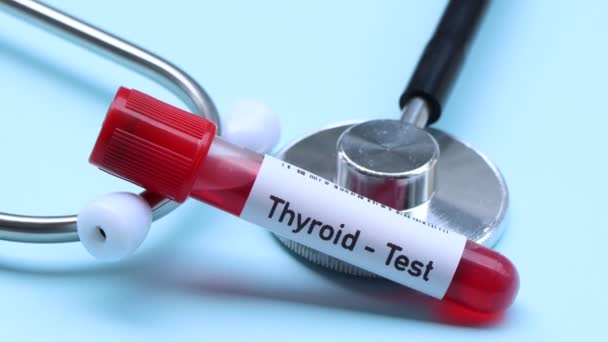 Thyroid Test Look Abnormalities Blood Blood Sample Analyze Laboratory Blood — Stock Video