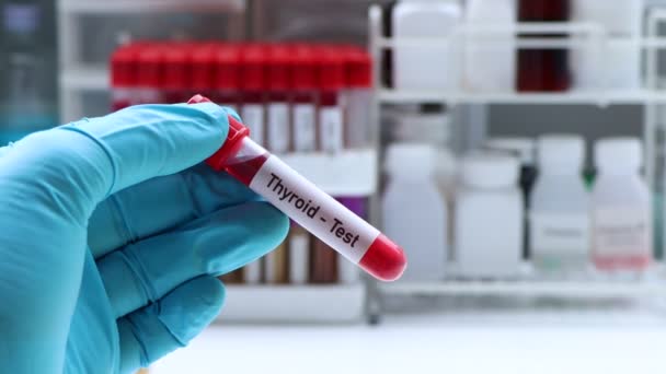 Τεστ Θυρεοειδούς Για Ψάξουν Για Ανωμαλίες Από Αίμα Δείγμα Αίματος — Αρχείο Βίντεο