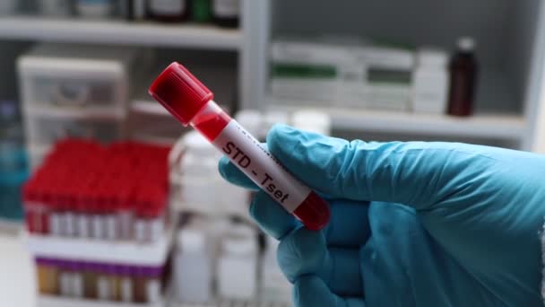 Test Std Cercare Anomalie Dal Sangue Campione Sangue Analizzare Laboratorio — Video Stock
