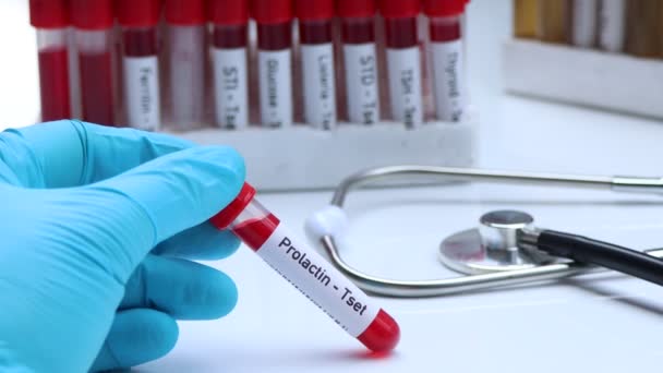 Tes Prolaktin Untuk Mencari Kelainan Dari Darah Sampel Darah Untuk — Stok Video