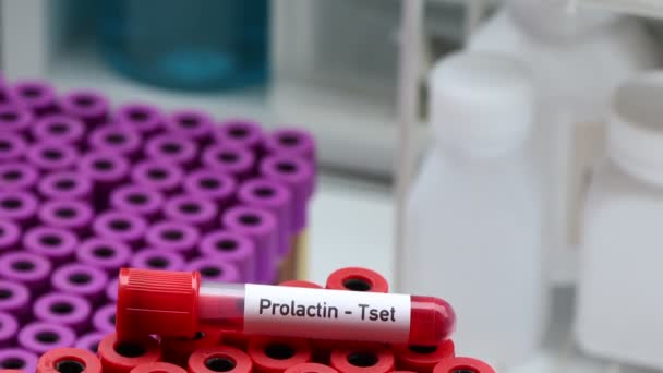 Prolactin Teszt Keresni Rendellenességek Vér Vérminta Elemezni Laboratóriumban Vér Kémcsőben — Stock videók