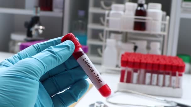 Listeria Test Look Abnormalities Blood Blood Sample Analyze Laboratory Blood — Stock Video