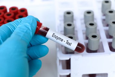 Enzim testi, laboratuvarda analiz edilecek kan örneği, test tüpünde kan.