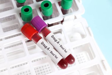 Grup A-Kan Testi, laboratuvarda analiz edilecek kan örneği, test tüpünde kan.
