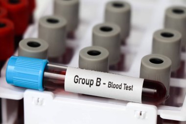 Grup B-Kan Testi, laboratuvarda analiz edilecek kan örneği, test tüpünde kan.