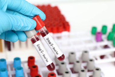 Grup 0 - Kan testi, laboratuvarda analiz edilecek kan örneği, test tüpünde kan.