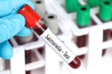 Salmonella testi, laboratuvarda analiz edilecek kan örneği, test tüpünde kan.