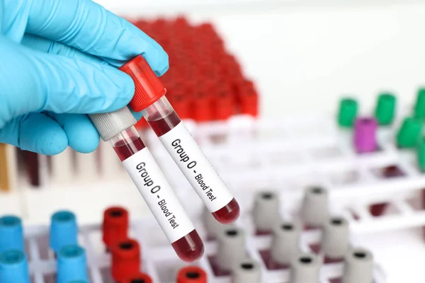 Grupo Análisis Sangre Muestra Sangre Para Analizar Laboratorio Sangre Tubo — Foto de Stock