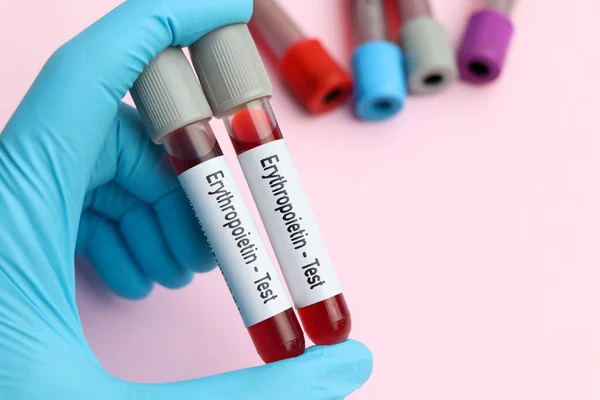 stock image Erythropoietin test, blood sample to analyze in the laboratory, blood in test tube