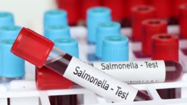 Salmonella testi, laboratuvarda analiz edilecek kan örneği, test tüpünde kan.