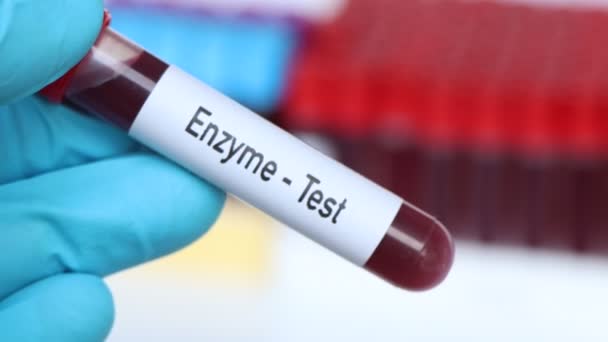 Enzym Test Bloedmonster Analyseren Het Laboratorium Bloed Reageerbuis — Stockvideo