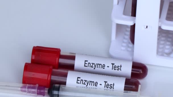 Teste Enzimático Amostra Sangue Para Analisar Laboratório Sangue Tubo Teste — Vídeo de Stock