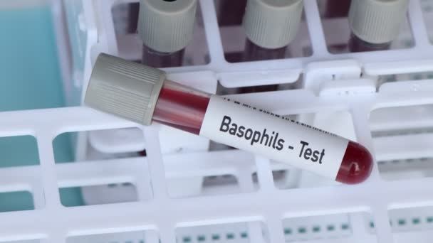 Basofils Test Blodprov Att Analysera Laboratoriet Blod Provröret — Stockvideo