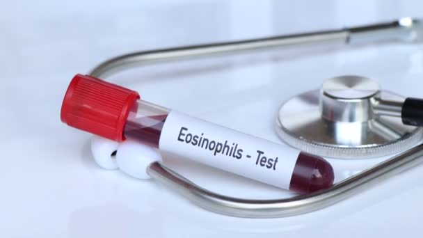 Eosinofielen Test Bloedmonster Analyseren Het Laboratorium Bloed Reageerbuis — Stockvideo