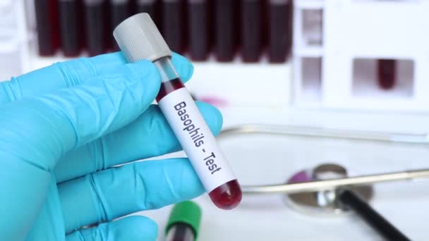 検査室で分析するための基礎テスト 血液サンプル 検査管内の血液 — ストック動画