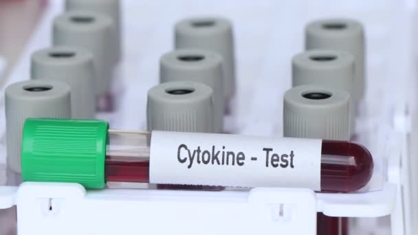 Цитокіновий Тест Аналіз Крові Лабораторії Кров Пробірці — стокове відео