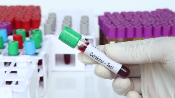 Teste Citocinas Amostra Sangue Para Analisar Laboratório Sangue Tubo Teste — Vídeo de Stock