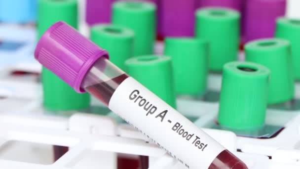 Grupo Análisis Sangre Muestra Sangre Para Analizar Laboratorio Sangre Tubo — Vídeo de stock