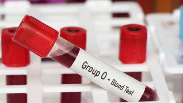 Ομάδα Εξέταση Αίματος Δείγμα Αίματος Για Ανάλυση Στο Εργαστήριο Αίμα — Αρχείο Βίντεο