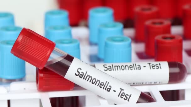Salmonella Test Bloedmonster Analyseren Het Laboratorium Bloed Reageerbuis — Stockvideo