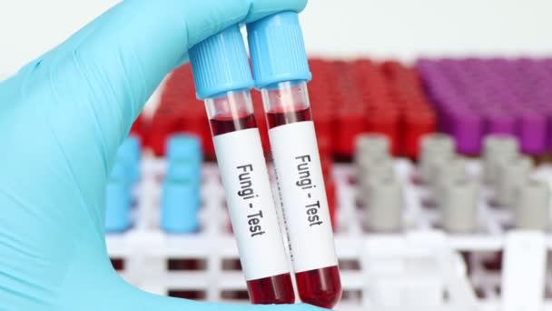 実験室で分析するためのFungiテスト 血液サンプル 試験管内の血液 — ストック動画
